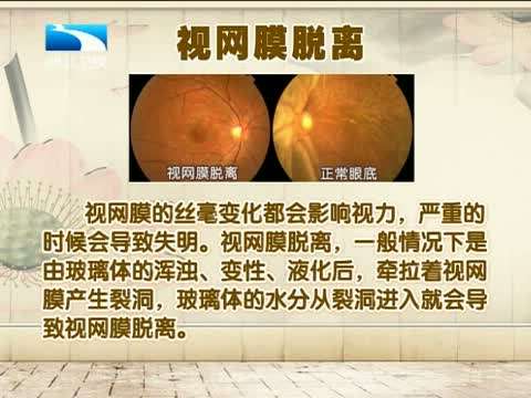 高度近視有什么危害